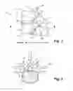 Fig. 02 - Method Of Surgically Implanting A Spinal Implant