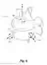 Fig. 06 - Method Of Surgically Implanting A Spinal Implant