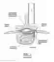 Fig. 02 - Configured and sized cannula