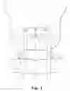 Fig. 02 - SIDE-LOADING OCCIPITAL VERTEBRAL FIXATION SYSTEM