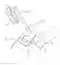 Fig. 01 - SPINAL PLUG FOR A MINIMALLY INVASIVE JOINT FUSION SYSTEM