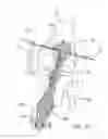 Fig. 09 - Apparatus and method for manipulating a flexible strand and soft tissue replacement during surgery