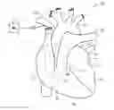 Fig. 01 - Methods for using a pulmonary artery electrode
