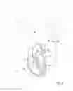 Fig. 09 - Using implanted sensors for feedback control of implanted medical devices