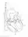 Fig. 01 - Cardiac rhythm management system with arrhythmia classification and electrode selection