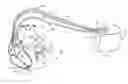 Fig. 01 - System and method for conditional biventricular pacing