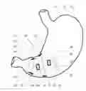 Fig. 01 - Feedback controlled gastro-intestinal stimulation