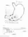 Fig. 02 - Feedback controlled gastro-intestinal stimulation