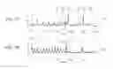 Fig. 06 - Feedback controlled gastro-intestinal stimulation