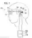 Fig. 02 - Sight regeneration assisting device