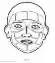 Fig. 16 - Methods and devices for non-ablative laser treatment of dermatologic conditions