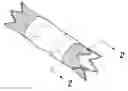 Fig. 01 - SILK STENT GRAFTS