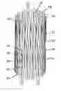 Fig. 01 - NEUROVASCULAR STENT AND METHOD
