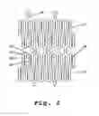 Fig. 04 - NEUROVASCULAR STENT AND METHOD