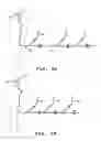 Fig. 07 - NEUROVASCULAR STENT AND METHOD