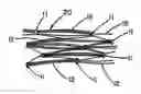 Fig. 01 - Intraluminal stent graft