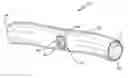 Fig. 01 - Method and device for facilitating surgical access to a body area