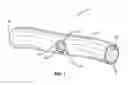 Fig. 02 - Method and device for facilitating surgical access to a body area
