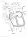 Fig. 06 - Method and device for facilitating surgical access to a body area