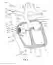 Fig. 07 - Method and device for facilitating surgical access to a body area