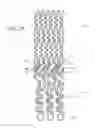Fig. 07 - Vascular bifurcation prosthesis with at least one frond