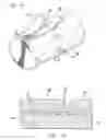 Fig. 06 - Mechanism for securing to a corporeal lumen and method of manufacturing