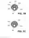 Fig. 07 - Methods, Compositions and Devices for Treating Lesioned Sites Using Bioabsorbable Carriers