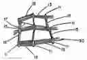 Fig. 01 - Intraluminal stent graft