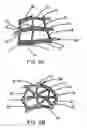 Fig. 03 - Intraluminal stent graft