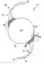 Fig. 01 - Intraocular lens for capsular bag