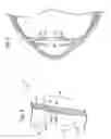 Fig. 03 - Intraocular lens for capsular bag
