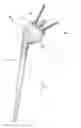 Fig. 01 - Shoulder arthroplasty system