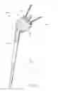 Fig. 02 - Shoulder arthroplasty system
