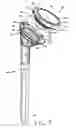 Fig. 08 - Shoulder arthroplasty system