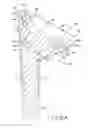 Fig. 09 - Shoulder arthroplasty system