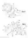 Fig. 08 - Elbow prosthesis