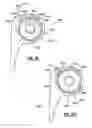 Fig. 28 - Elbow prosthesis