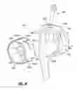 Fig. 30 - Elbow prosthesis