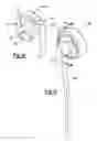 Fig. 40 - Elbow prosthesis