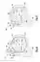 Fig. 44 - Elbow prosthesis