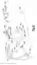 Fig. 46 - Elbow prosthesis
