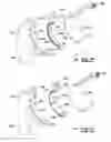Fig. 49 - Elbow prosthesis
