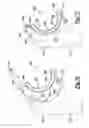 Fig. 50 - Elbow prosthesis