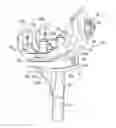 Fig. 01 - Knee and shoulder joint prosthesis