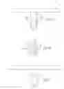 Fig. 03 - Knee and shoulder joint prosthesis