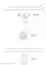 Fig. 04 - Knee and shoulder joint prosthesis