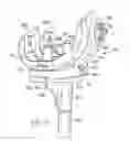 Fig. 11 - Knee and shoulder joint prosthesis