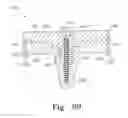 Fig. 49 - Mobile/fixed prosthetic knee systems