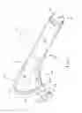 Fig. 02 - Prosthetic hip implants
