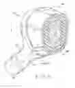 Fig. 06 - Prosthetic hip implants